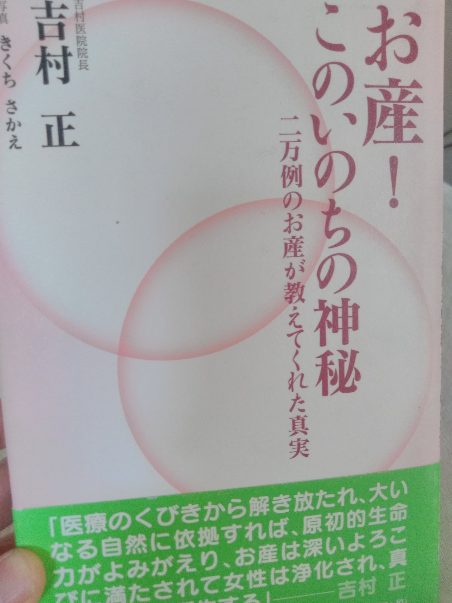 逆子の経腟分娩